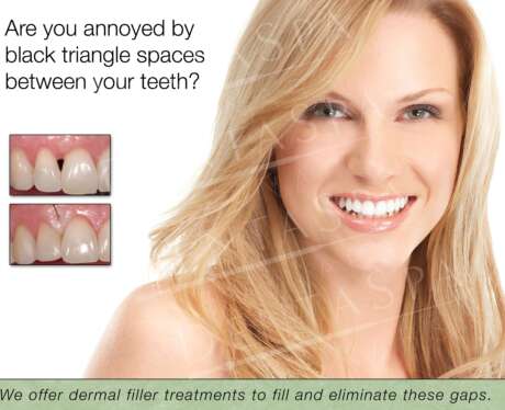 Black Triangles A Poster