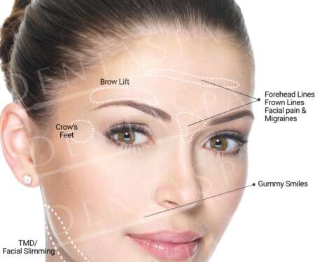 Botox Treatment A Poster