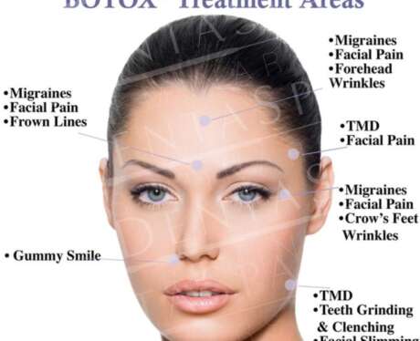 Botox Treatment E Poster