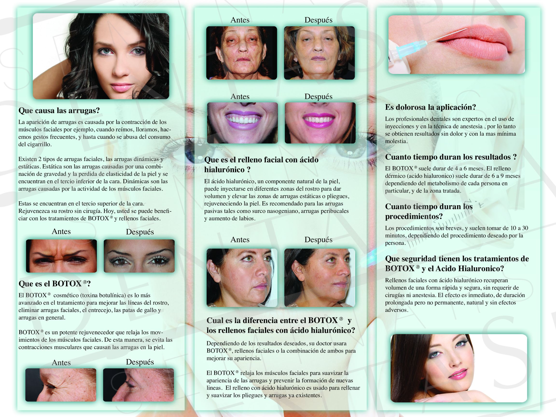 Inside Botox and Rellenos Faciales Brochure