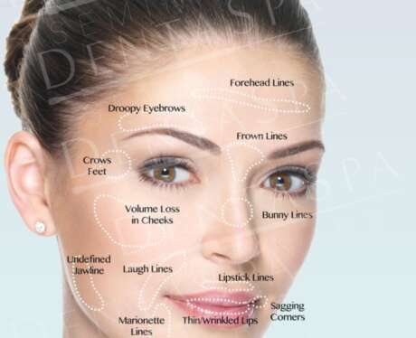 Dermal Fillers B Poster