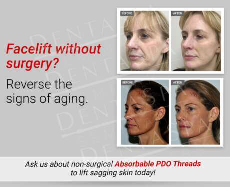 Facelift without Surgery C Poster
