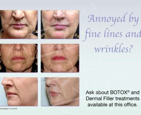 Fine Lines and Wrinkles A Poster