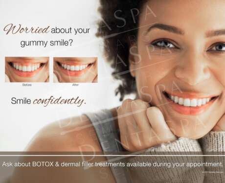 Gummy Smile A Poster