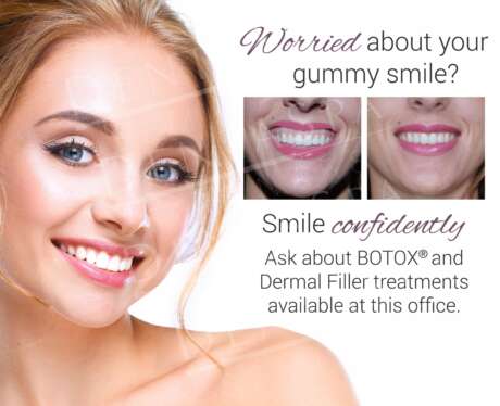 Gummy Smile C Poster