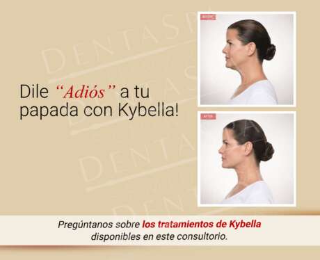 Kybella- Adios Papada Poster