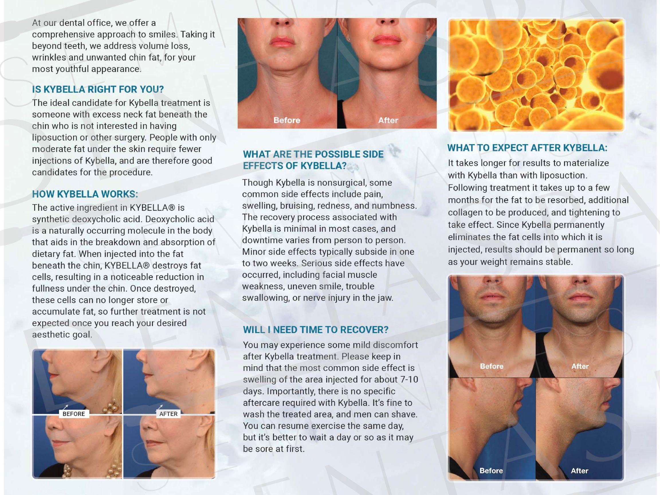 Kybella Brochure Inside