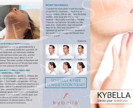 Kybella Brochure