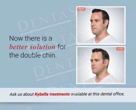Kybella Treatment B Poster