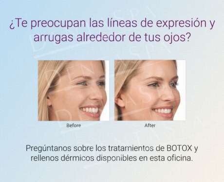 Lineas Alrededor de tus ojos