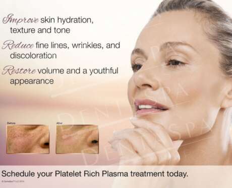 PRP Before and After Poster