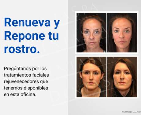 Renueva y Respone tu Rostro Poster