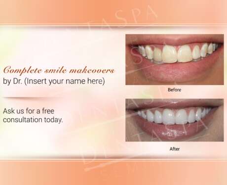 Smile Makeover Consultation Poster