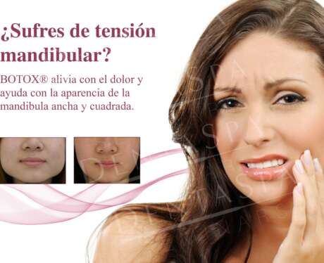 Sufres de tension Mandibular Poster