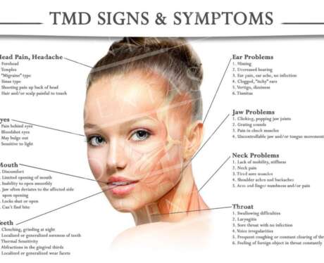 TMD Signs and Symptoms Poster