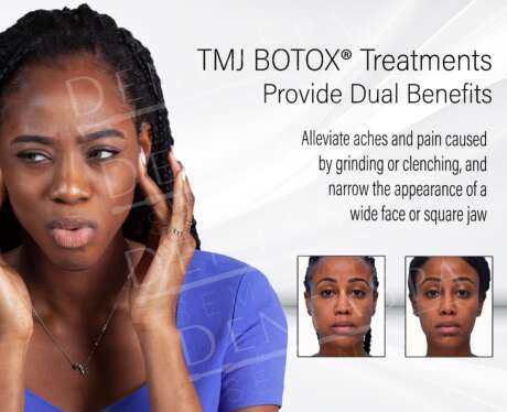 TMJ BOTOX Poster
