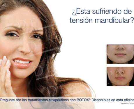 Tension Mandibular B Poster