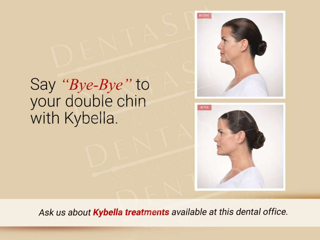 Kybella Treatment C Poster