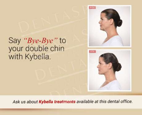 Kybella Treatment C Poster