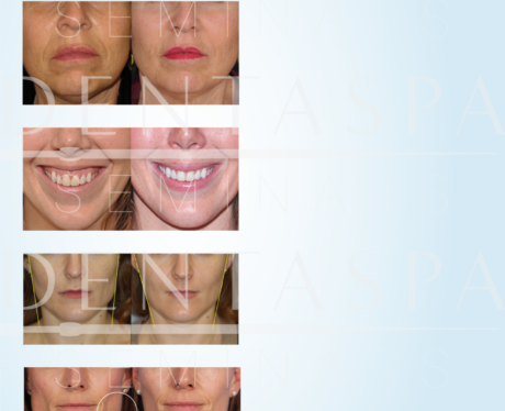 D1 Dental Therapeutic Brochure Holder